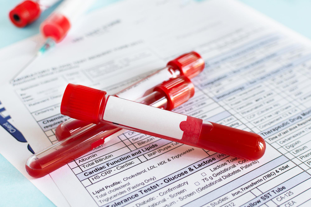 diagnose Hematuria